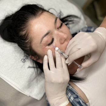 БІОРЕВІТАЛІЗАЦІЯ ЗОНИ НАВКОЛО ОЧЕЙ
                    Косметолог Елена Винница