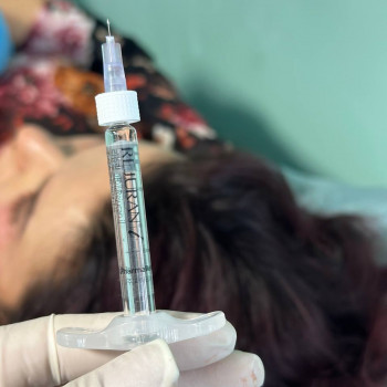 БІОРЕВІТАЛІЗАЦІЯ ЗОНИ НАВКОЛО ОЧЕЙ
                    Косметолог Елена Винница