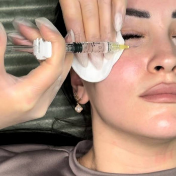 БІОРЕВІТАЛІЗАЦІЯ ЗОНИ НАВКОЛО ОЧЕЙ
                    Косметолог Елена Винница