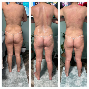 ОБГОРТАННЯ ТІЛА
                    Косметолог Елена Винница