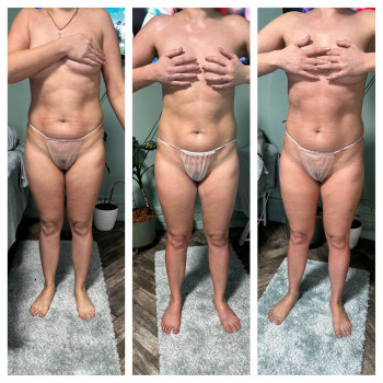 ОБГОРТАННЯ ТІЛА
                    Косметолог Елена Винница