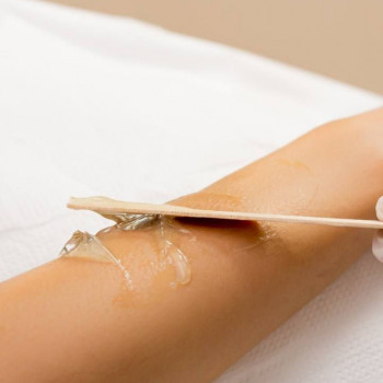 ЛАЗЕРНА ЕПІЛЯЦІЯ
                    Косметолог Елена Вінниця