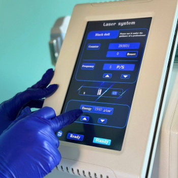 КАРБОНОВИЙ ПІЛІНГ
                    Косметолог Елена Винница