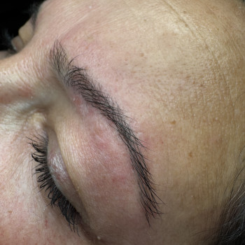 Зона брів.
Корекція за допомогою ЕЛЕКТРОЕПІЛЯЦІЇ.