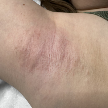 Інна Явтушенко, Харків Фото - 10