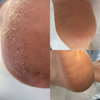 Євгенія Гордіюк, Кременчук Фото - 21