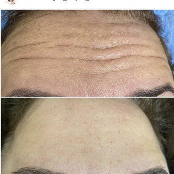 Галина Карауш, Київ Фото - 2