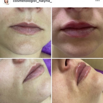 Галина Карауш, Київ Фото - 3