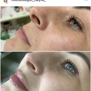 Галина Карауш, Київ Фото - 4