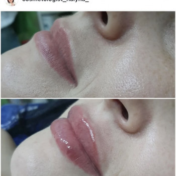 Галина Карауш, Київ Фото - 5