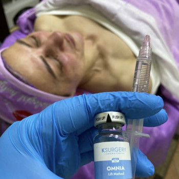 Галина Карауш, Київ Фото - 6