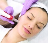 Мікронідлінг(Мезотерапія обличчя).Відчутний результат після першої процедури. Массажист Наталья Днепр