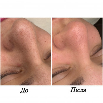 Марченко Ольга Лавринович, Житомир Фото - 18