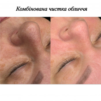 Марченко Ольга Лавринович, Житомир Фото - 34