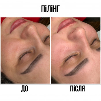 Марченко Ольга Лавринович, Житомир Фото - 4