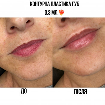 Марченко Ольга Лавринович, Житомир Фото - 5