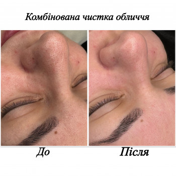 Марченко Ольга Лавринович, Житомир Фото - 7