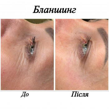 Марченко Ольга Лавринович, Житомир Фото - 9