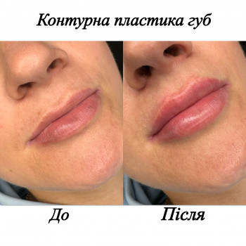 Марченко Ольга Лавринович, Житомир Фото - 12