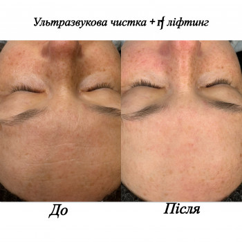 Марченко Ольга Лавринович, Житомир Фото - 13