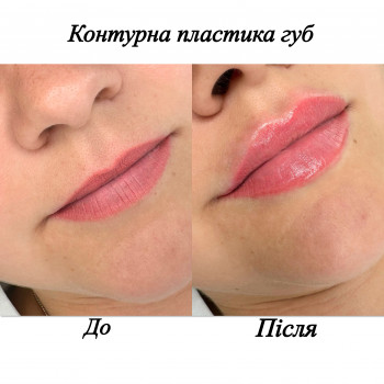 Марченко Ольга Лавринович, Житомир Фото - 14