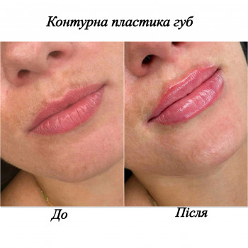 Марченко Ольга Лавринович, Житомир Фото - 15