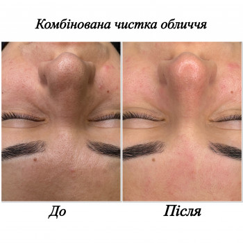 Марченко Ольга Лавринович, Житомир Фото - 2