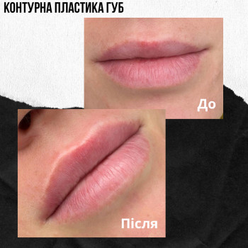 Марченко Ольга Лавринович, Житомир Фото - 17