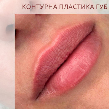 Марченко Ольга Лавринович, Житомир Фото - 31