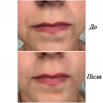 Марченко Ольга Лавринович, Житомир Фото - 30