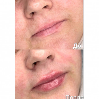 Марченко Ольга Лавринович, Житомир Фото - 28