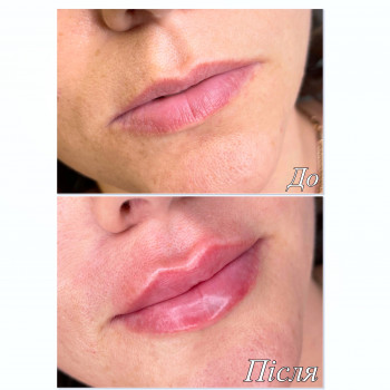 Марченко Ольга Лавринович, Житомир Фото - 19