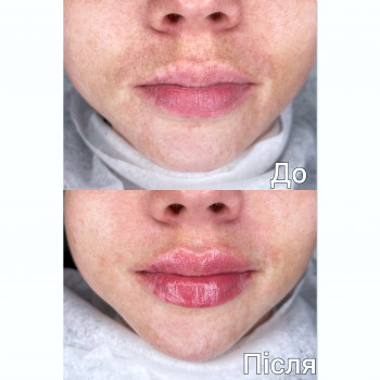 Марченко Ольга Лавринович, Житомир Фото - 25