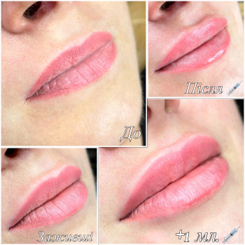 Марченко Ольга Лавринович, Житомир Фото - 24