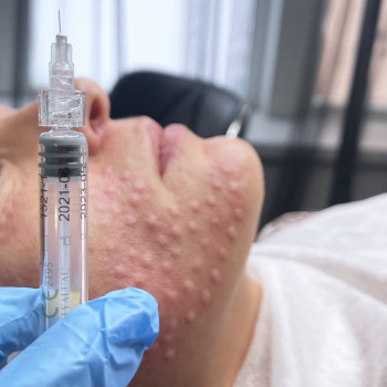 Марченко Ольга Лавринович, Житомир Фото - 23