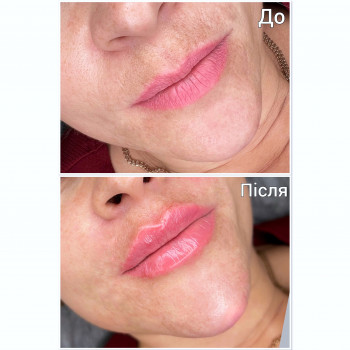 Марченко Ольга Лавринович, Житомир Фото - 69