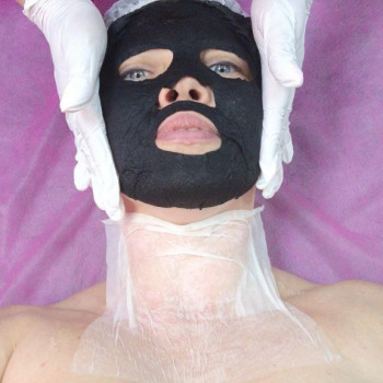 Карбоксітерапія
 