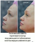 Авторский 3 D лифтинговый массаж Косметолог-ін'єкціоніст Наталья Олеговна Харків