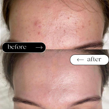 Safe Cosmo Kyiv, Киев Фото - 97