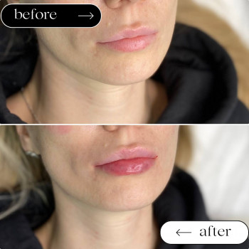  

 

 

 

 ’єкціїКраси

 

 