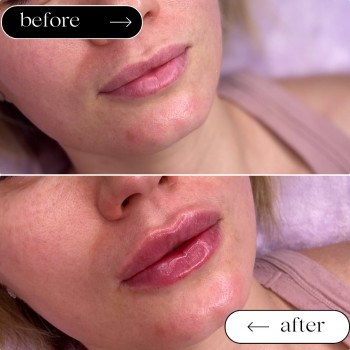  

 

 

 

 ’єкціїКраси

 

 