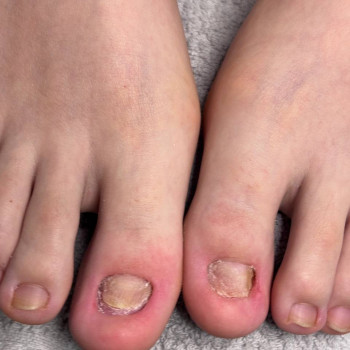 Олена Шибанова, Черкаси Фото - 16