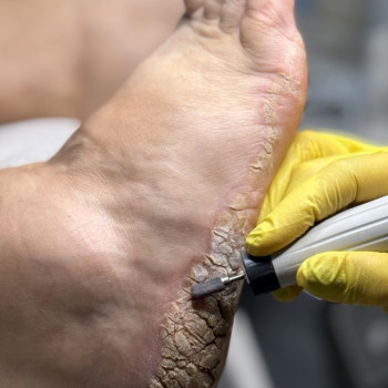 Олена Шибанова, Черкаси Фото - 17