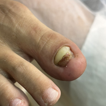 Олена Шибанова, Черкаси Фото - 4