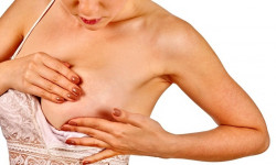 Збільшення об'єму сосків Студия лазерной эпиляции Центр лазерної косметології Луцк