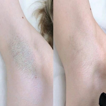 LaserTime, Рівне Фото - 10