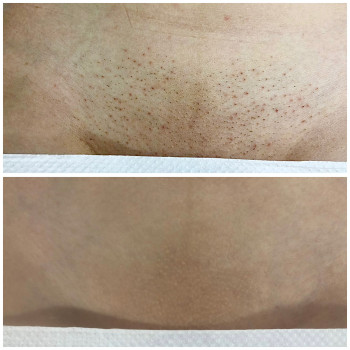 LaserTime, Рівне Фото - 11