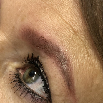 Брови одразу після процедури