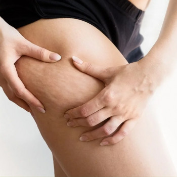 Аромамасаж з ефірним оліями
                    Масажист Тамара Одеса