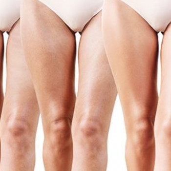 Тамара Леонова, Одесса Фото - 5